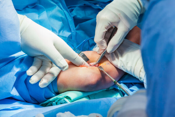 Elbow Surgeries
