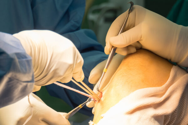 Knee Surgeon